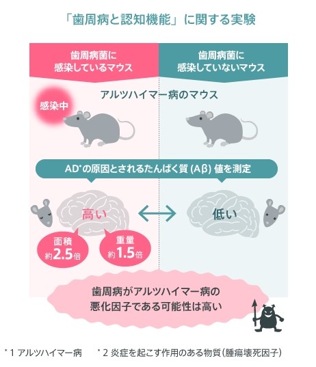 Pg菌とアルツハイマー型認知症の関連性