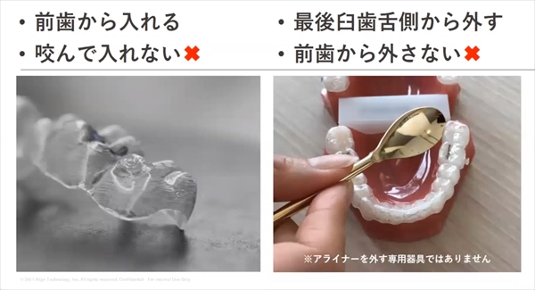 脱着時の操作ポイント