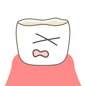 歯が磨り減って短くなり、しみる