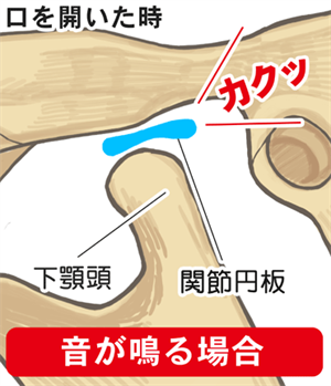 音を発するメカニズム