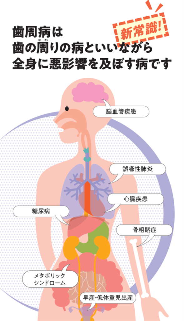 歯周病と全身疾患の関係