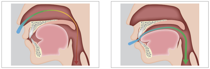 鼻呼吸ではなく口呼吸が正解