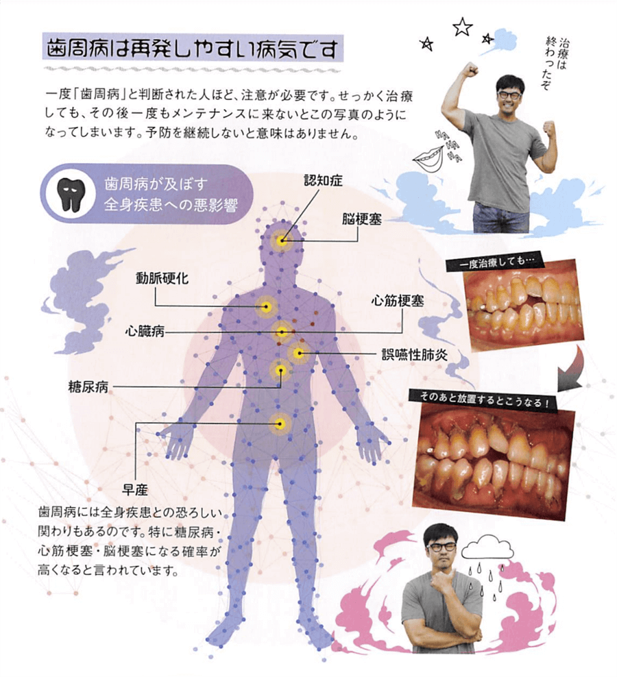 メインテナンス重視が昨今の歯科医療のトレンド！③