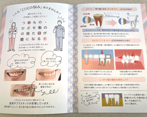 お配りしてるニュースレター「いい歯通信」の中味