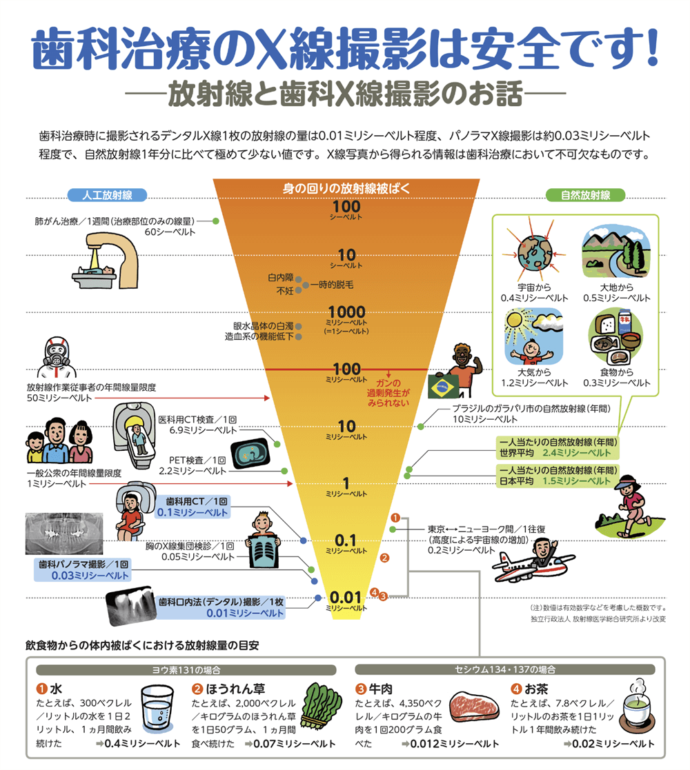 レントゲンの被曝量