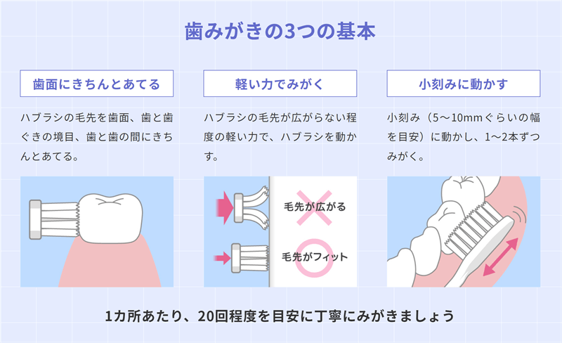 ブラッシングの基本事項