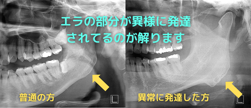 異様に発達した額角部