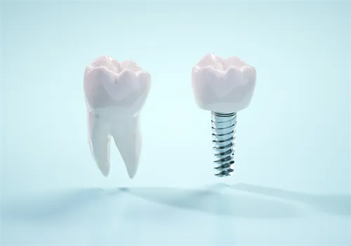 人工の歯根が存在