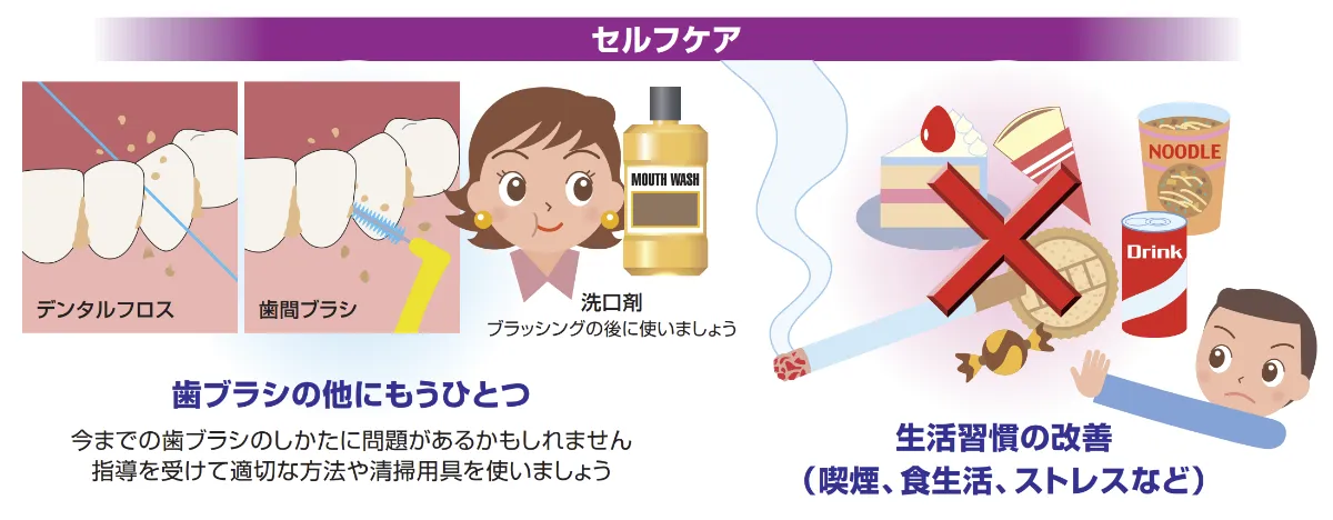 歯周病対策のセルフケア