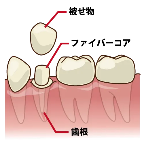 金属アレルギー情報⑥