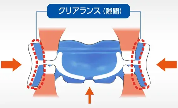 プレオルソの仕組み3