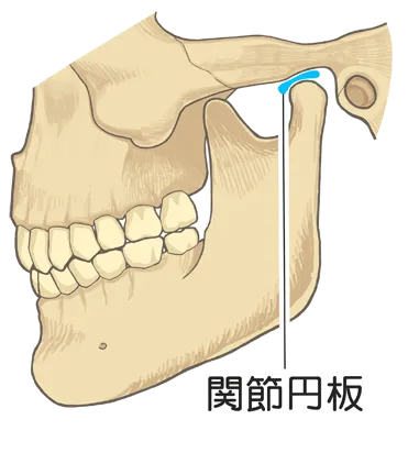 顎関節症2