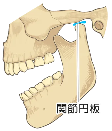 顎関節症3
