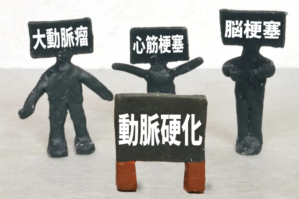 動脈硬化②