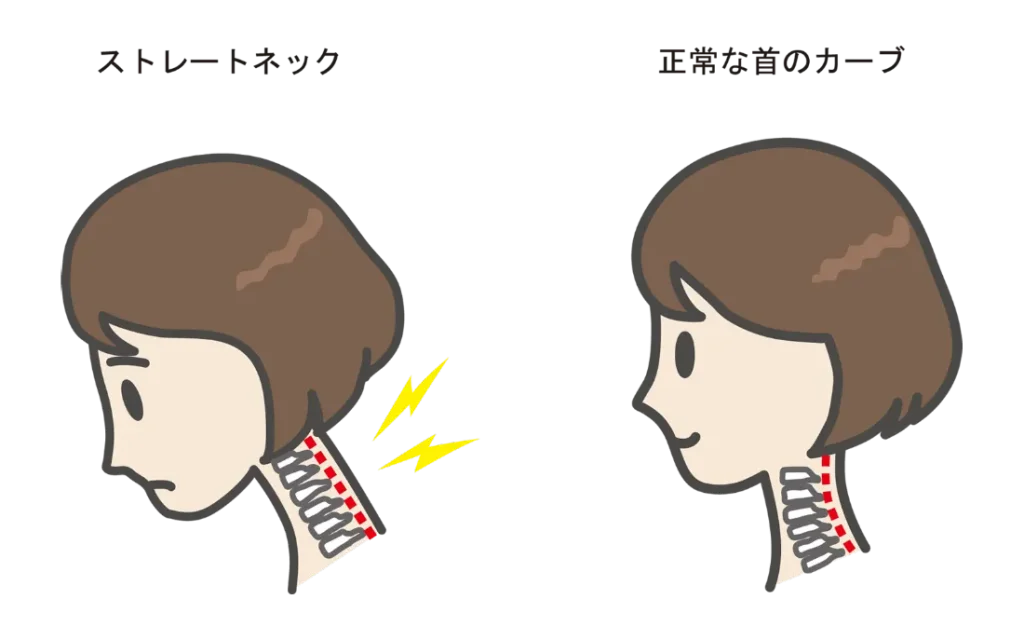 ストレートネック⑧