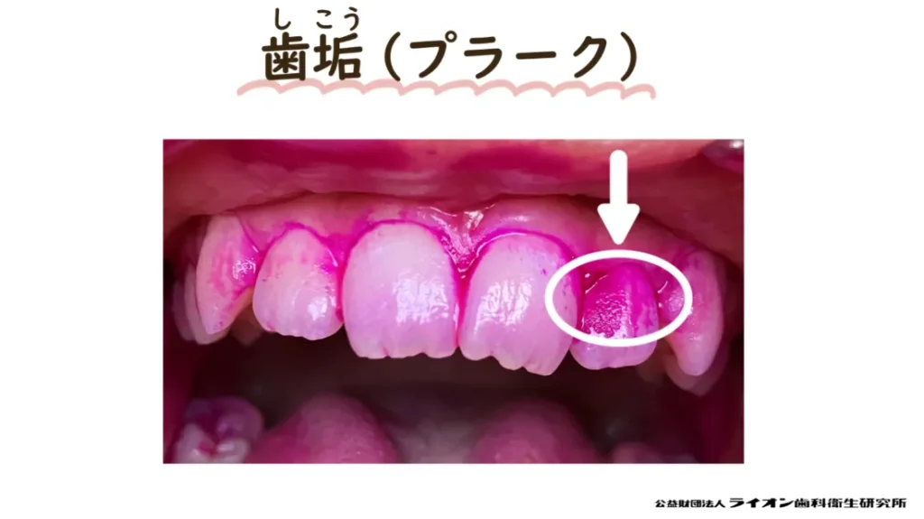 歯磨き教室⑯