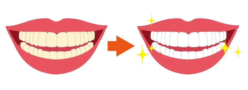 ホワイトニングで白くなるイメージ・イラスト