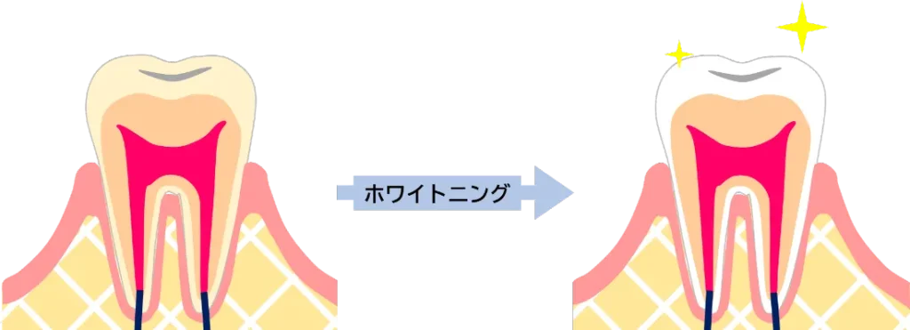 ホワイトニングのイメージ・イラスト