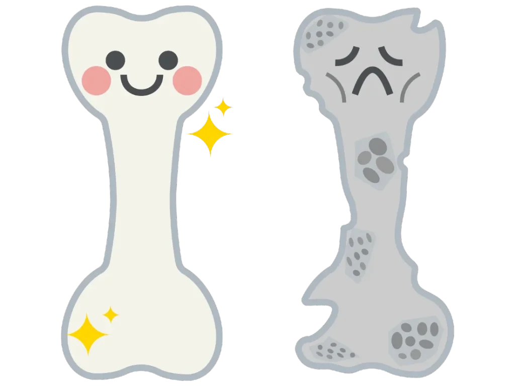 骨粗しょう症⑤