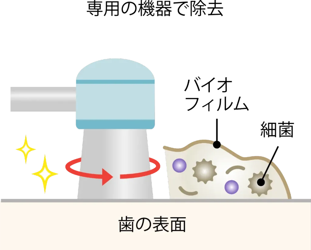 PMTC・バイオフィルム⑧