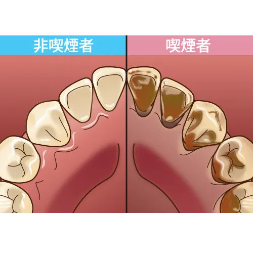 喫煙③