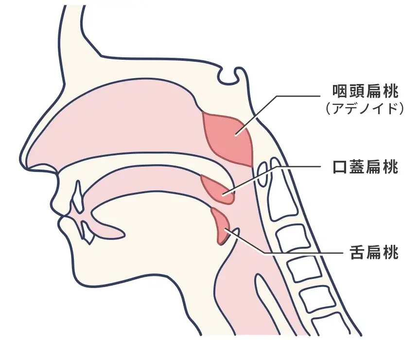 咽頭扁桃（アデノイド）