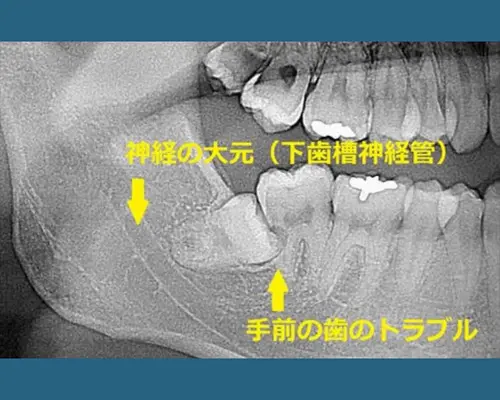 間に合わなかった症例①