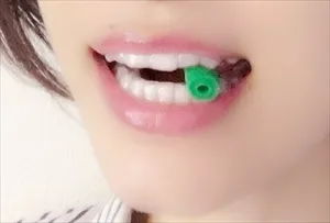 インビザラインのアライナーを押し込むためのチューイー