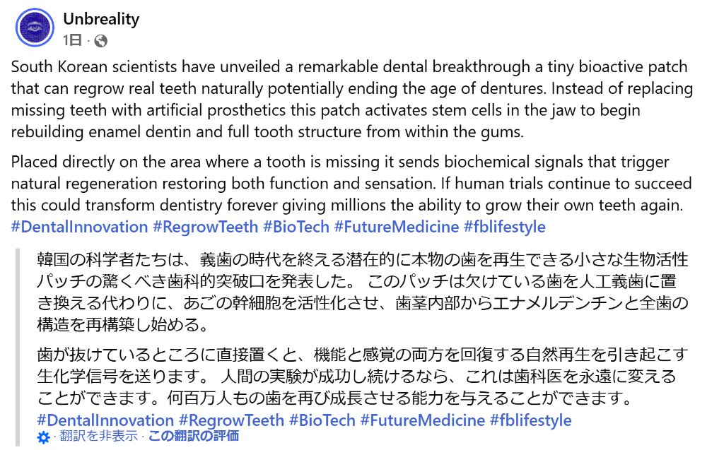 本物の歯が再び生えてくる？韓国で話題の「歯の再生パッチ」のSNS投稿文（英語と日本語訳）