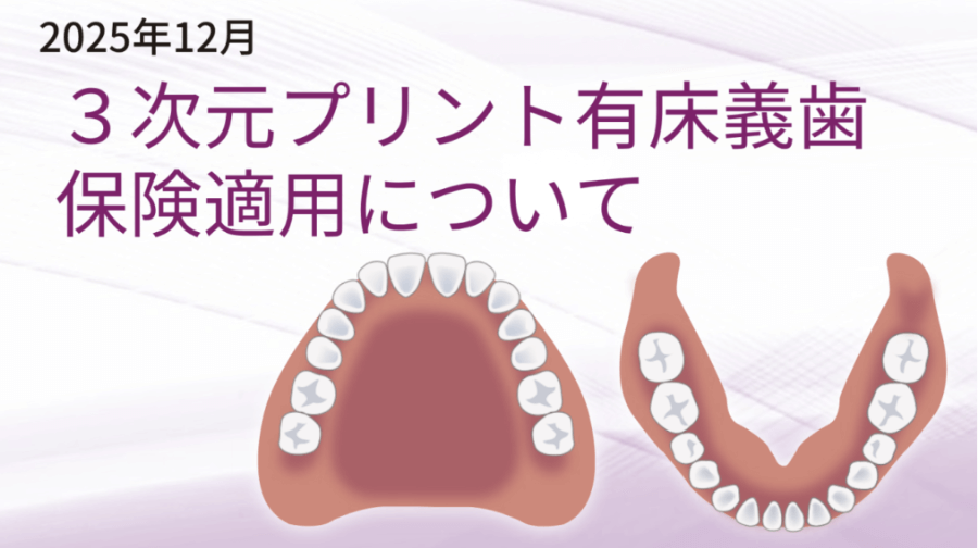 保険適用になった3次元プリント有床義歯に関するイラスト