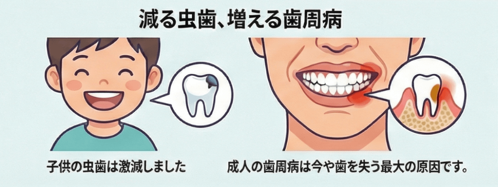 子どもの虫歯は激減している一方、大人の歯周病が歯を失う最大の原因となっていることを示すイラスト