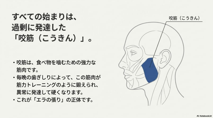 歯ぎしりにより咬筋が過剰に発達し、エラの張りが生じる仕組みを示した解剖イラスト