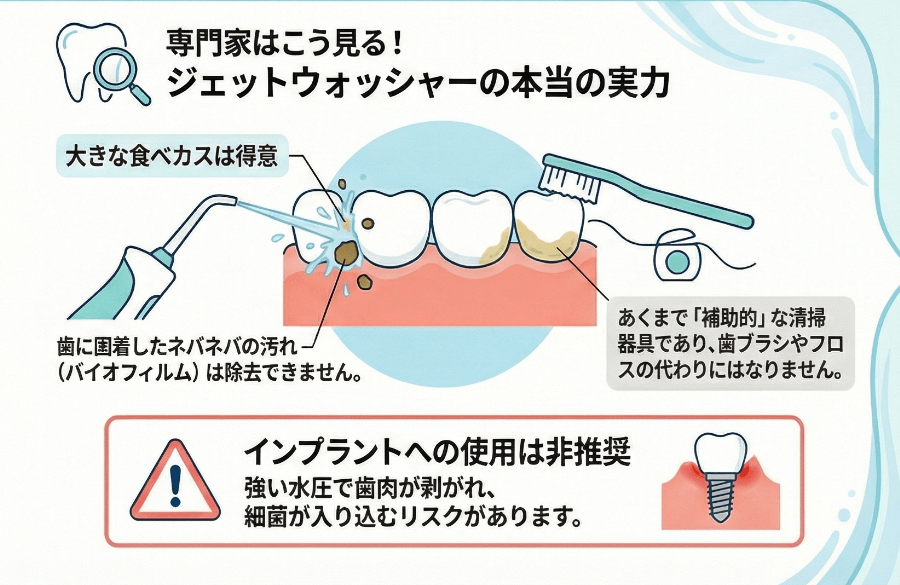 歯科専門家の視点で解説するジェットウォッシャーの清掃効果と限界を示したイラスト