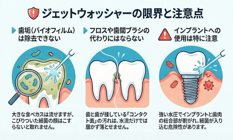 ジェットウォッシャーでは歯垢やコンタクト面の汚れを完全に除去できないことを示す図