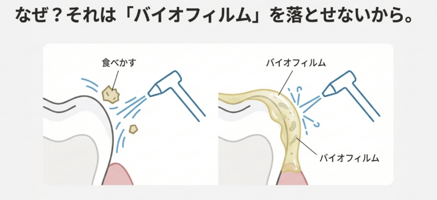 ジェットウォッシャーではバイオフィルムが除去できない理由を示した比較イラスト