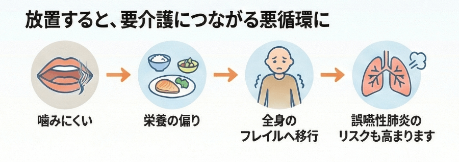 お口の衰えから始まるオーラルフレイルと誤嚥性肺炎までの悪循環を示した図解