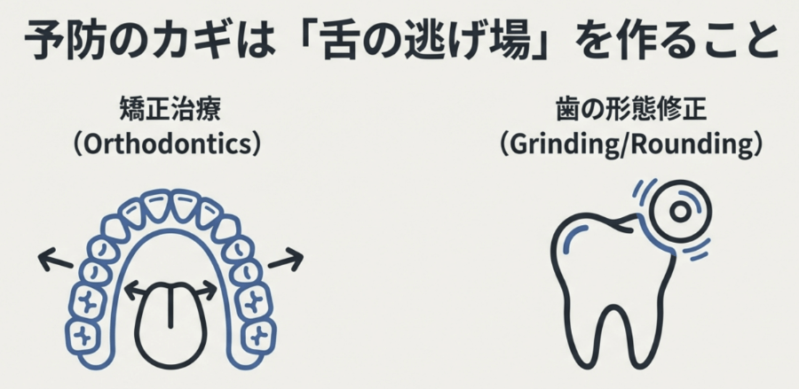 舌への刺激を減らすための矯正治療や歯の形態修正による予防方法の図