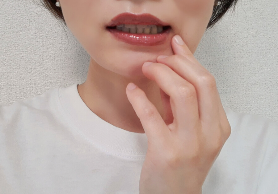 口の中に違和感があり、唇の内側を気にして触れている写真