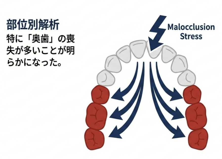 噛み合わせの乱れによるストレスが奥歯に集中し、歯の喪失リスクが高まることを示す図