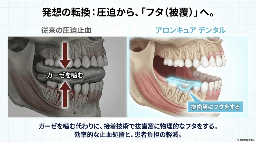 ガーゼで圧迫する従来法と、接着技術で抜歯窩にフタをするアロンキュア デンタルの比較イラスト