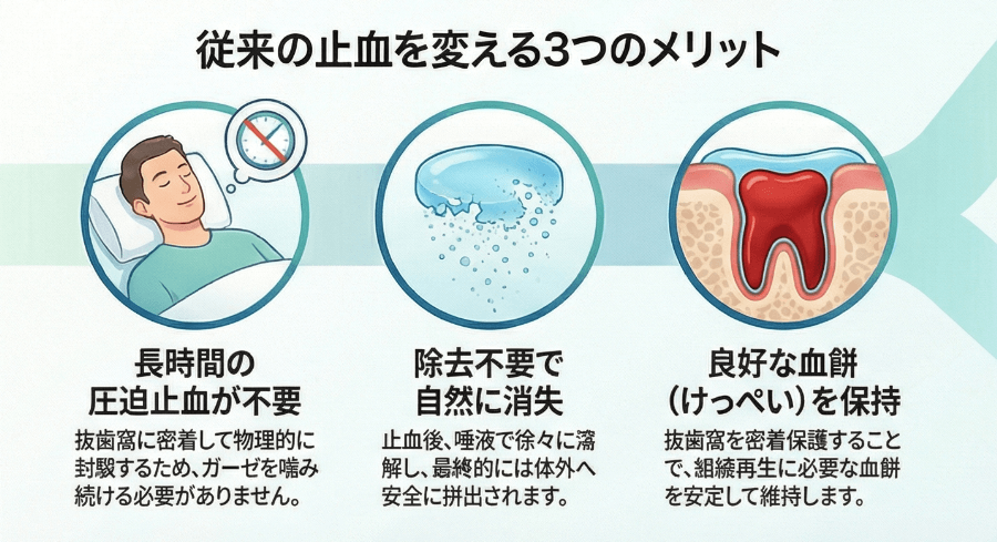 アロンキュア デンタルの3つのメリット（長時間圧迫不要・自然消失・血餅保持）を解説したイラスト
