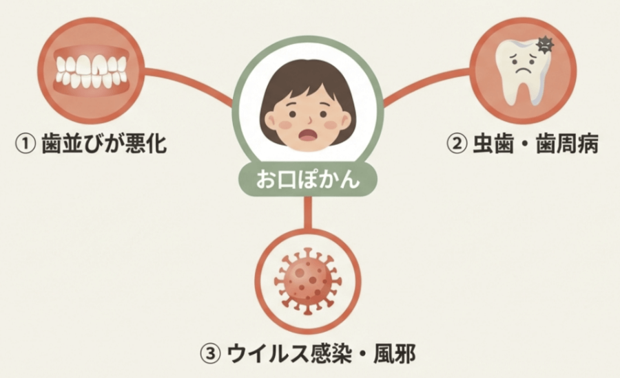 お口ぽかんが歯並び悪化・虫歯リスク・ウイルス感染につながることを示す図解