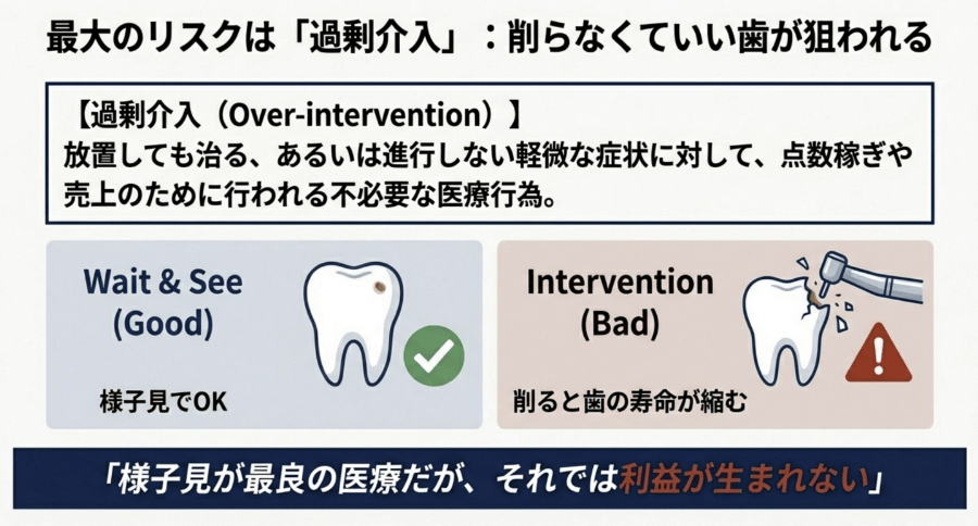 過剰介入とは何かを示す図。削らなくてよい歯は様子見が最良で、不要な治療は歯の寿命を縮めることを解説