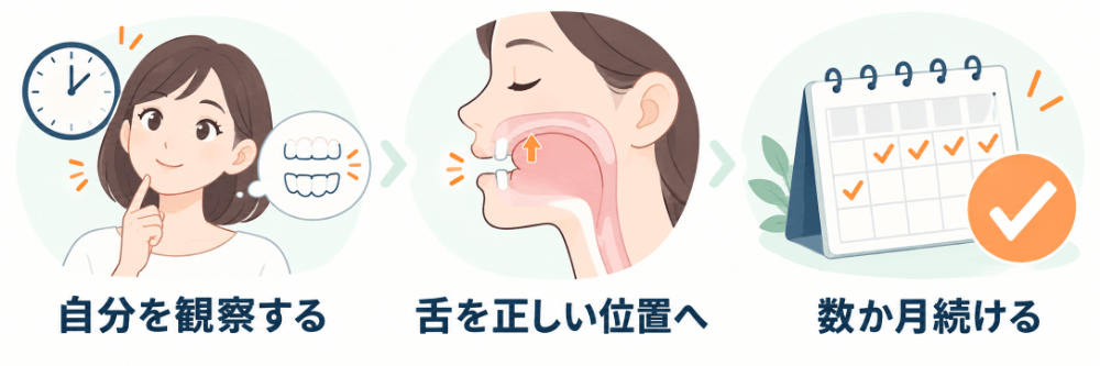 TCH改善の3ステップ:自分の癖を観察する、舌の先を上の前歯の付け根の少し後ろに置いて歯を離す、数か月続ける