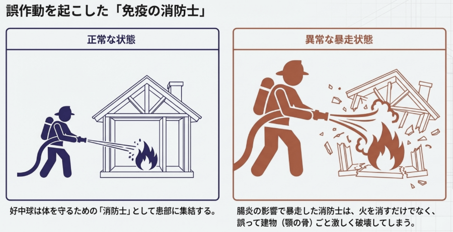 免疫の暴走を消防士に例えた図｜本来守るはずの体を壊す仕組み