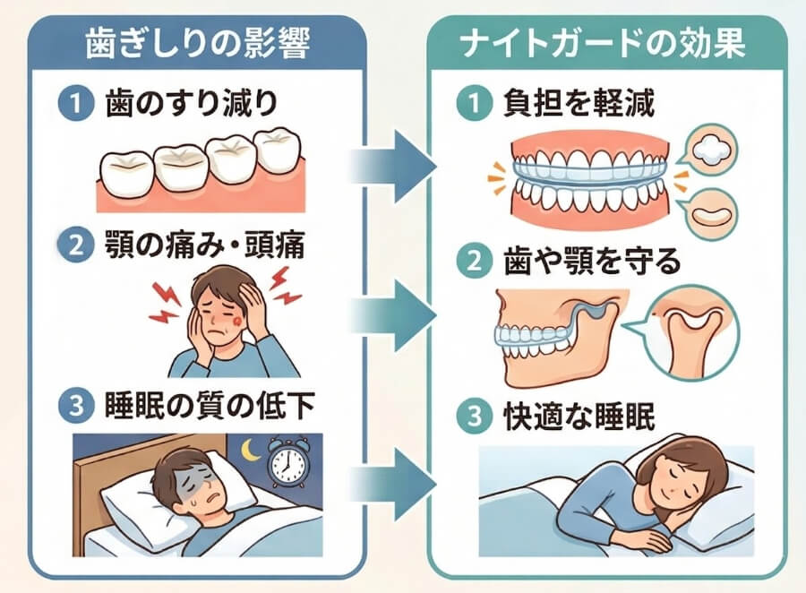 歯ぎしりの影響(歯のすり減り・顎の痛みと頭痛・睡眠の質の低下)とナイトガードの効果(負担軽減・歯や顎を守る・快適な睡眠)の比較イラスト