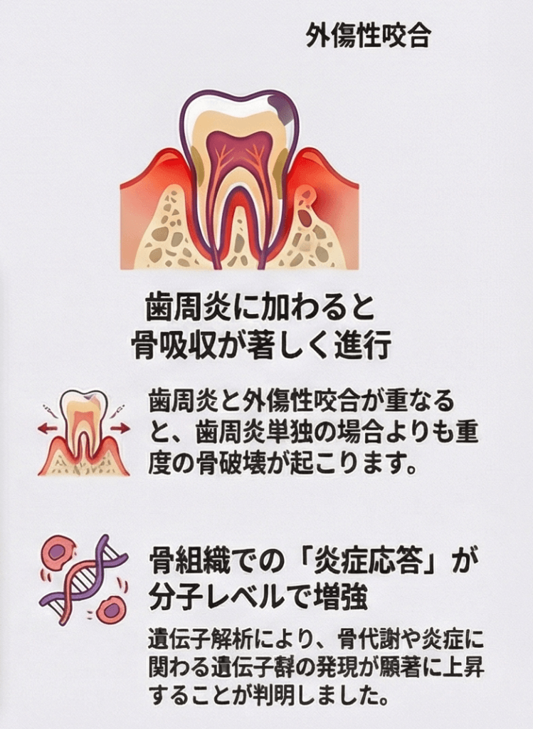 歯周炎に外傷性咬合が加わると骨吸収が著しく進行し骨組織の炎症応答が分子レベルで増強することを示すインフォグラフィック