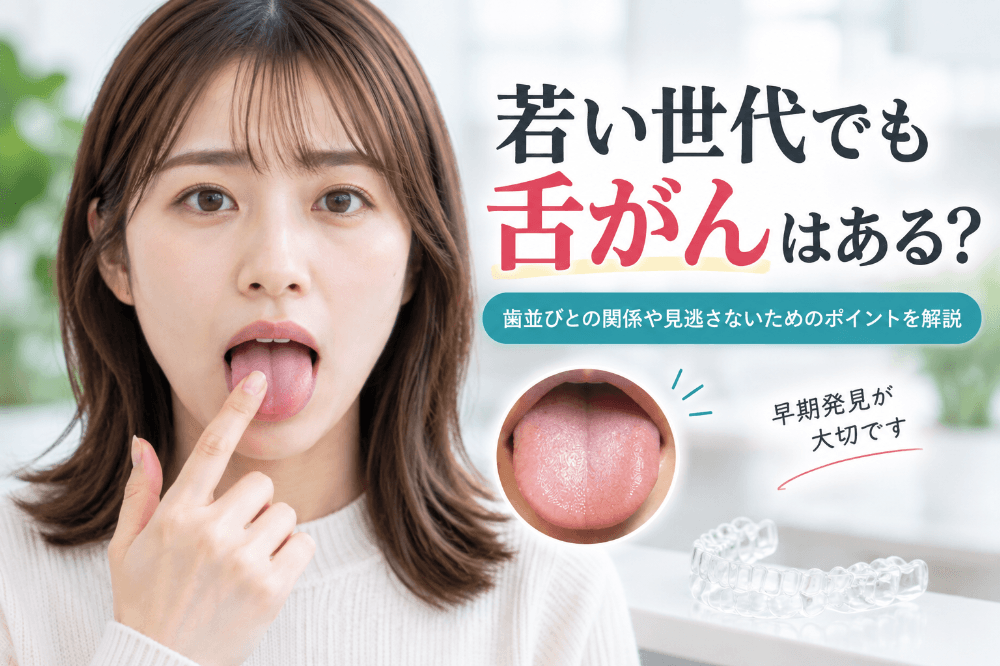 若い世代の舌がんと歯並びの関係、見逃さないためのポイントを歯科医師が解説する記事のアイキャッチ画像