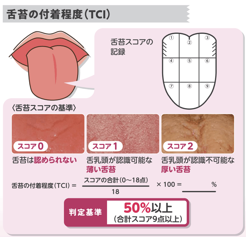 舌苔の付着程度（TCI）の判定図：スコア0〜2の舌苔の状態と、舌を9分割して記録する方法、判定基準50%以上（合計スコア9点以上）を示す図解