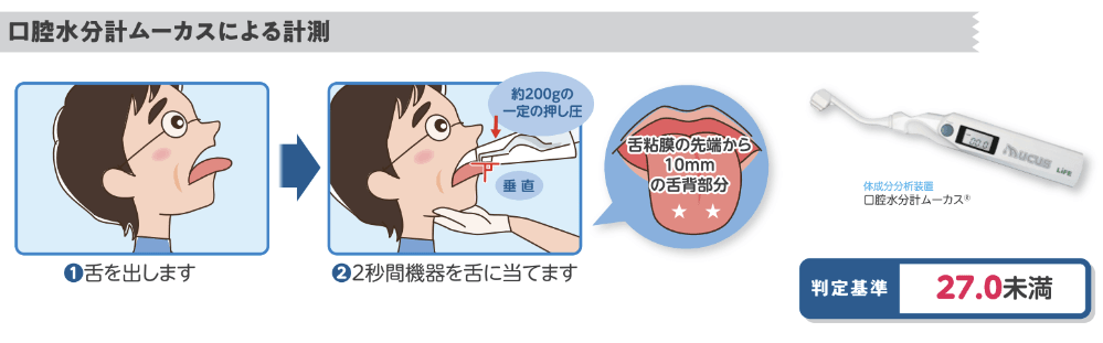 口腔水分計ムーカスによる口腔乾燥検査の手順図：舌を出し、舌背部に約200gの一定圧で2秒間機器を当てる方法と、判定基準27.0未満を示すイラスト
